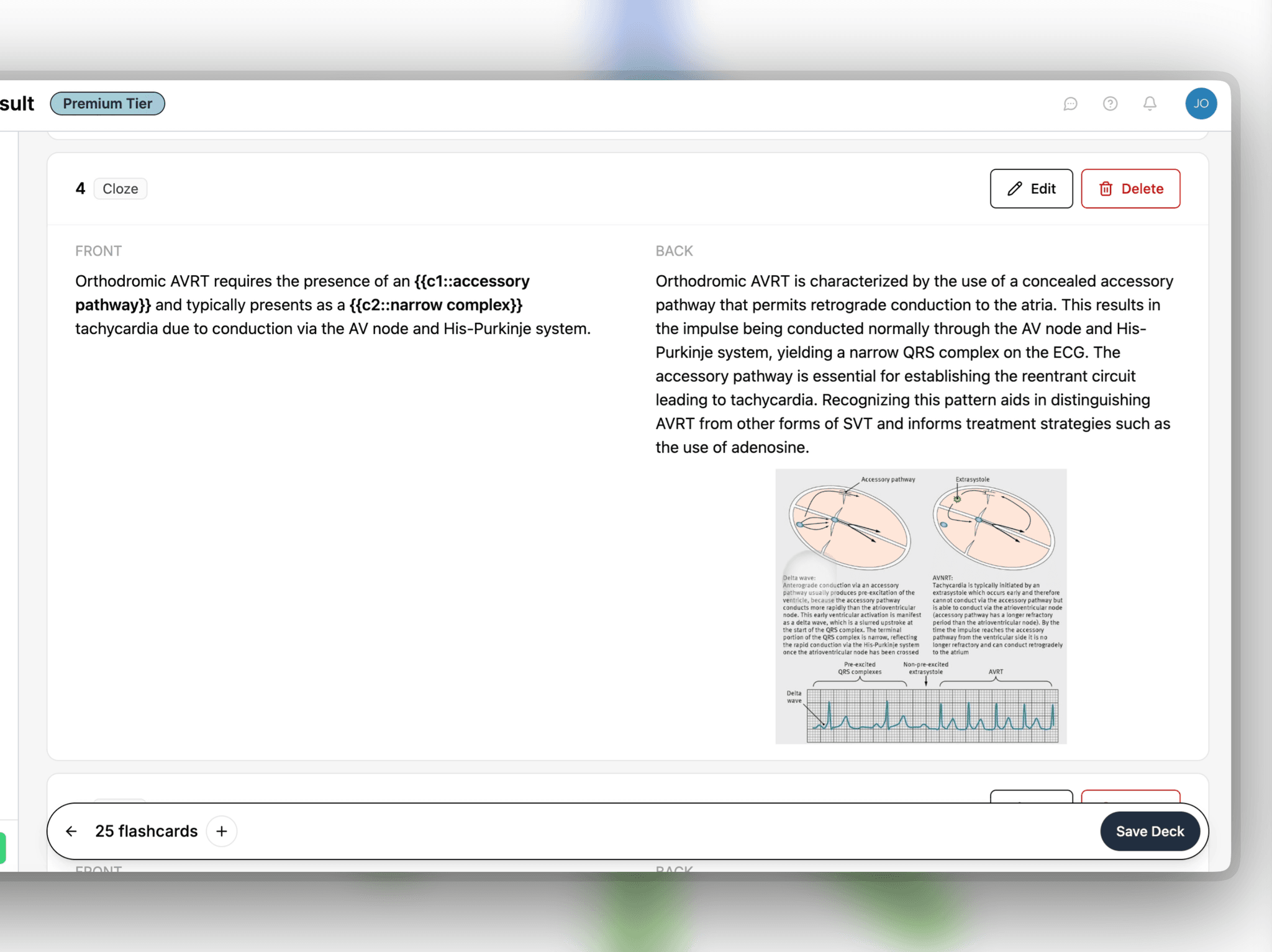 Step 2: View and edit the cards generated